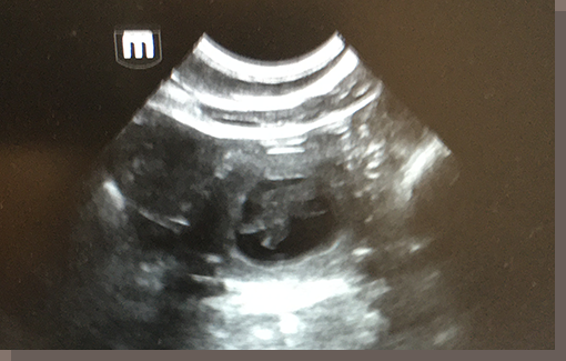 Eins der E-chen in seiner Fruchtblase